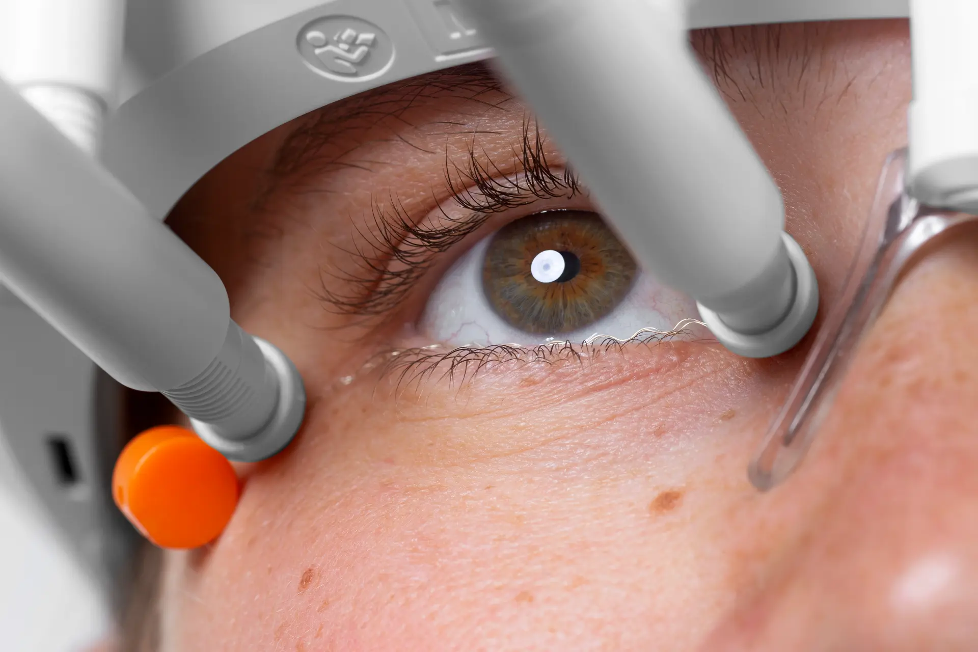 OkuStim2 bei Retinitis Pigmentosa